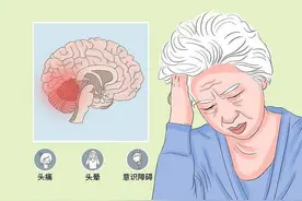 「科普」外伤跌倒摔伤头部，要是有过昏迷，时间再短也要警惕图片
