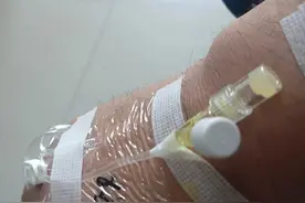 医院亲历结肠息肉手术图片