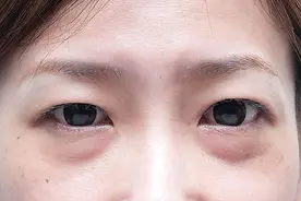 50岁女人如果有“眼袋”，不要想着割，这4招比跑美容院管用图片