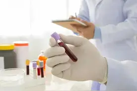 血常规检查中，如果3个指标升高，可能与疾病有关，尽量不要忽视图片