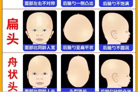 如何成功睡出小圆头！完整版图片