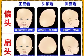 如何成功睡出小圆头！完整版图片