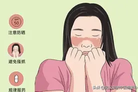 脸上红红的一片是怎么回事图片