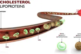 “甘油三酯大户”被揪出，医生：不想血管硬化，请少碰这几种食物图片