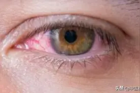 一个对眼睛超好的中成药，化解眼睛干涩、模糊、怕光、流泪、近视图片