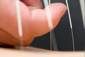 实锤！针灸治疗对多种疾病有效，5大疑问一次说清图片