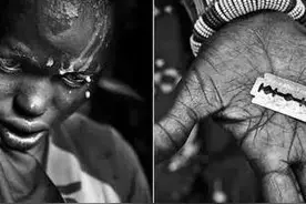 女性私处“割礼”泛滥，索马里的女性多绝望？图片