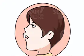 孩子牙畸形，要做矫正吗？暨大穗华口腔提醒这8点别忽视图片