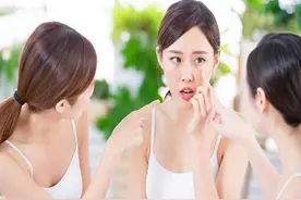 长了黄褐斑，很难祛除？它的出现多半与4个原因有关，需对症处理图片