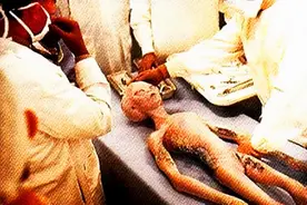 100万美元起拍！外星人解剖证据被拍卖，罗斯威尔事件真相如何图片