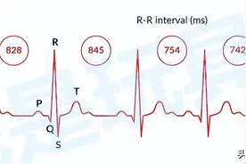 浅谈：佳明、博能、高驰运动表 HRV 功能的区别图片