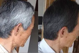 央视曝光！这些黑发产品千万别用了,对人体伤害太大,建议了解一下图片