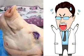 整形美容：不想被练手，割双眼皮花多少钱比较合适？图片