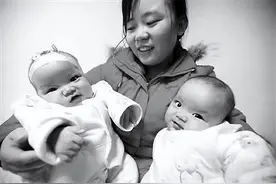 09年，湖北妈妈生下“连体婴儿”，经手术分离，俩人长得眉清目秀图片