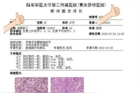 新疆患者CT结果显示双肺多发50多个肺结节，全部都要切掉吗？图片