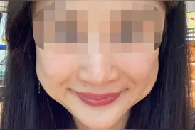 ​大连女子花4万多块钱做医美，结果变成“青蛙脸”…图片