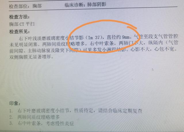 刘懿博士说肺癌（五六六三）从im33到im37，这是同一个肺结节么？