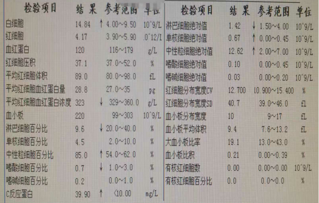 未婚女子突发急性乳腺炎，高烧不退彻夜难眠！止痛消肿该怎么治疗