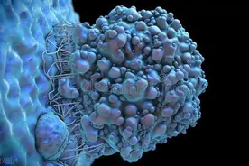 有些痣会癌变，这几个信号千万别忽略！教您自查找出黑色素瘤图片