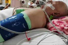 有可能治成“活死人”的脑出血患者，选择治和不治，都是正确的图片
