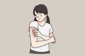 荨麻疹症状是什么？饮食少吃6食物，原因、治疗一次看图片