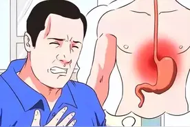 食道炎是什么？它会导致食管癌吗？图片