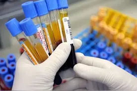 血常规可以看出是否患有癌细胞吗？若这3个指标升高，或需要注意图片