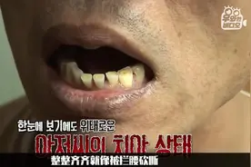 晚上睡觉磨牙不是小问题！你的身体很可能出现了这4大毛病图片