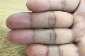 你手上有几个斗，几个簸箕？看“斗”知富贵？中科院发现基因奥秘图片