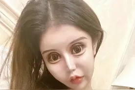 16岁整容百次，如今面目全非记忆力衰退，她却说：享受整容的快感图片