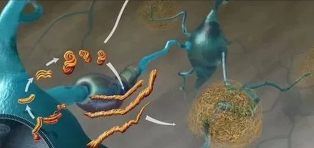 鐑圭叜閮芥潃涓嶆鐨勬湂鐥呮瘨锛岃嚧姝荤巼100%鏃犺嵂鍙晳锛佹劅鏌撳悗鏈夊鎭愭€栵紵