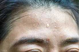 额头鼻头、后背腋下、手心脚心老出汗，身体竟出问题，如何调养？图片