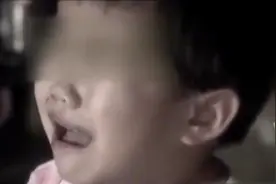 海南4岁女孩因腹痛晕倒，只是因为吃了口肉，医生检验说明真相图片