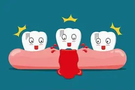 牙龈发炎肿痛怎么缓解图片