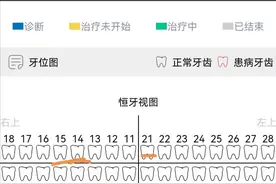 不到万不得已，千万不要补牙图片