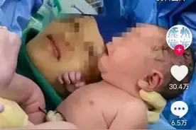 武汉夫妻生下镜面宝宝，内部器官看起来就像是被倒置，医生：难养图片