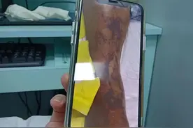 被蚂蚁咬了而已，却进了重症ICU图片