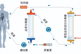 机器竟能代替人的器官？生物型人工肝或成为肝衰竭患者的救命神器图片