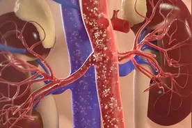 避免陷入肌酐的认知误区，七个常识你要掌握！图片