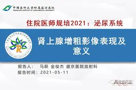 肾上腺增粗影像表现及意义图片