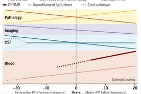 《科学》：帕金森病研究新突破！在手抖之前及时发现风险图片