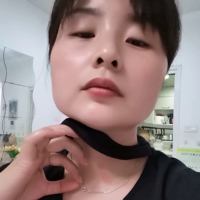 炒菜被油烫了怎么办
