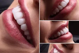 牙齿美白的辟谣指南图片