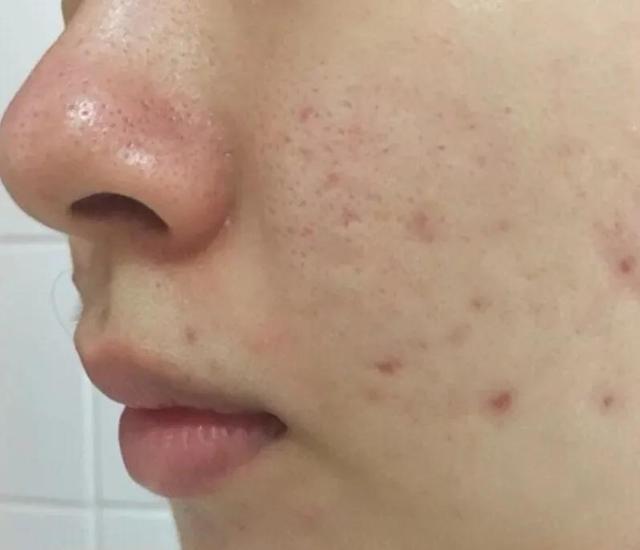 实测九款洗面奶：旁氏便宜但爆痘过敏！两款国货洁面值得入手