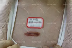郑州市第二中医院科普：胸前长疤痕疙瘩怎么办？图片