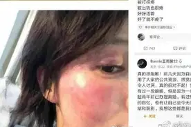 娱乐圈又出下头男？黄景瑜婚内不忠家暴？图片