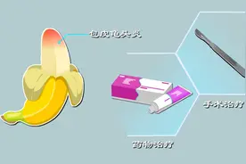 丁丁瘙痒恐是龟头炎？哪些情况要割包皮？科学解读龟头炎权威疗法图片