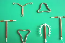 中国第一批“上环”的女性，医生直言：30年了，难逃出这4种结局图片