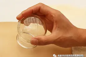 长治市中医研究所附属医院：平衡火罐图片
