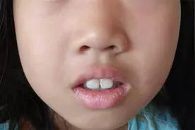 孩子张嘴睡觉，打鼾，越长越丑？说一张实用方，改善娃腺样体肥大图片